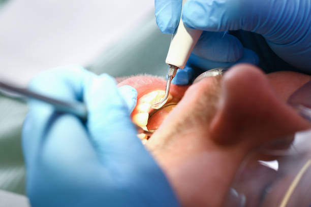 Best After-Hours Emergency Dentist in Gleneagle, CO