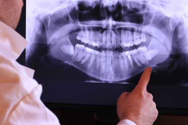 Best Walk-In Emergency Dentist in Gleneagle, CO